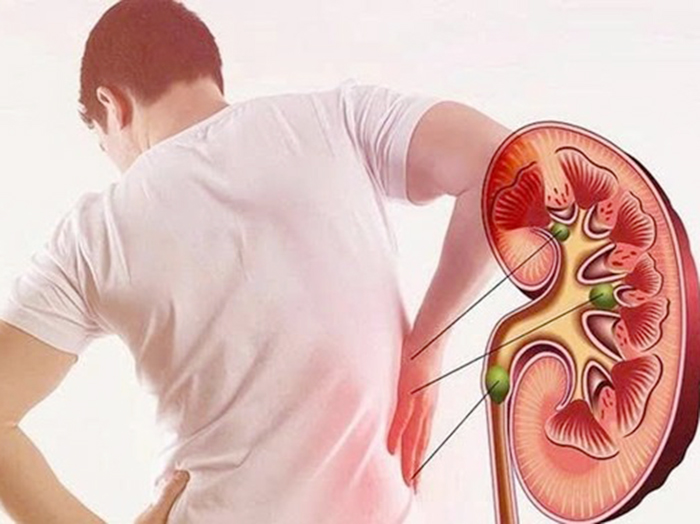 Bệnh mạn tính thường gặp hiện nay? Mẹo sống chung bệnh mạn tính an toàn