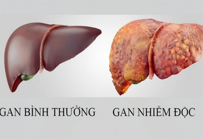 Tảo Xoắn Nhật hỗ trợ tăng cường sức khoẻ gan và thanh lọc cơ thể